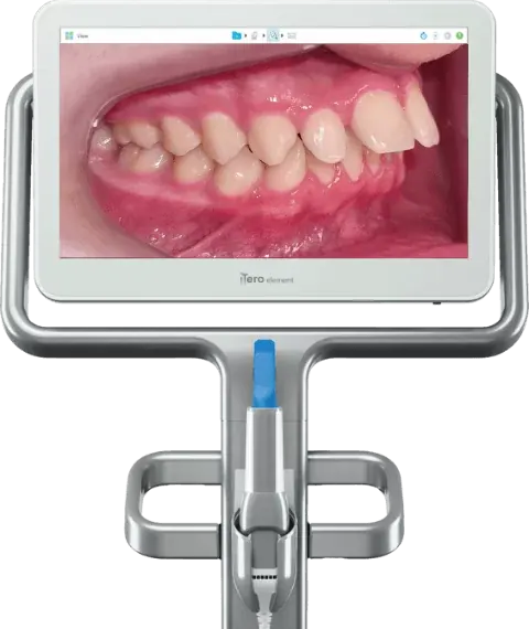 Antes do tratamento Invisalign